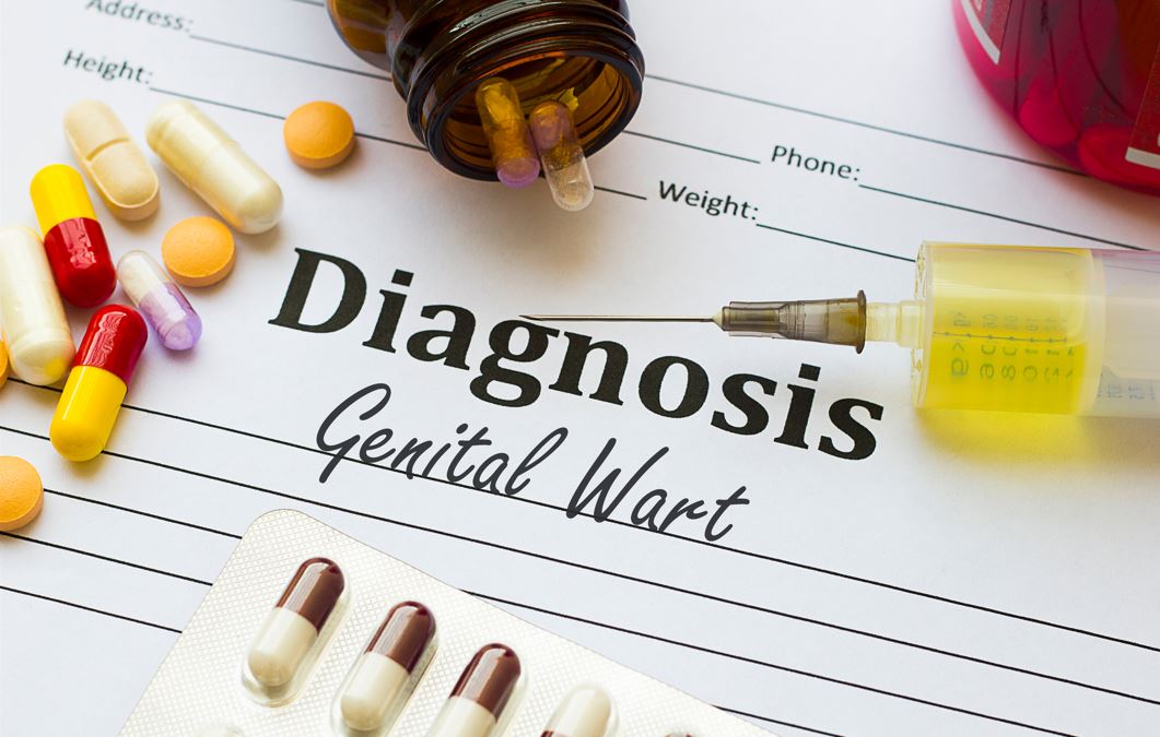 Everything you need to know about genital warts
