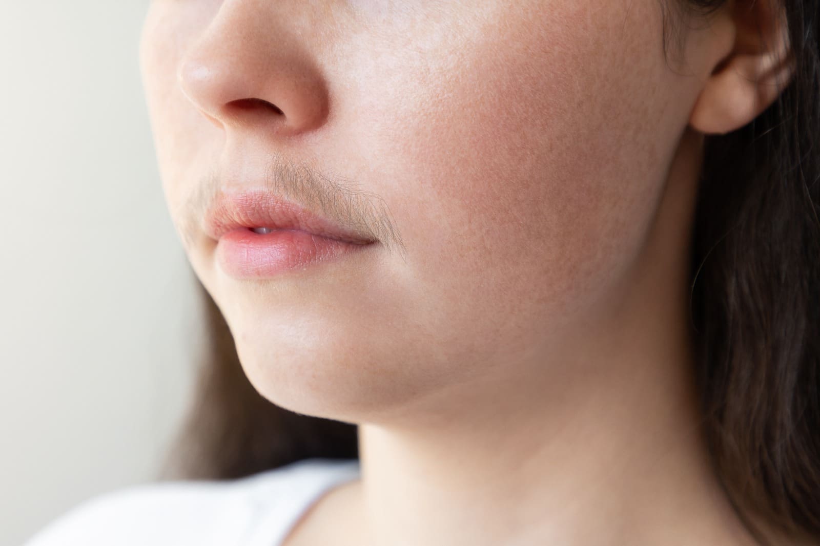 Hirsutism treatment strategies for smoother skin
