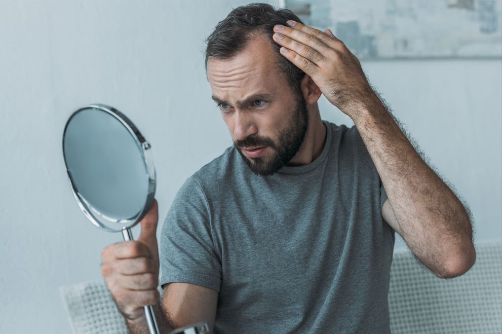 Exploring stages of male pattern baldness to promote hair growth