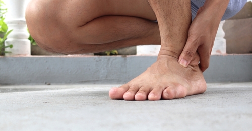 7 Best ways to Deal with Painful Gout Attacks