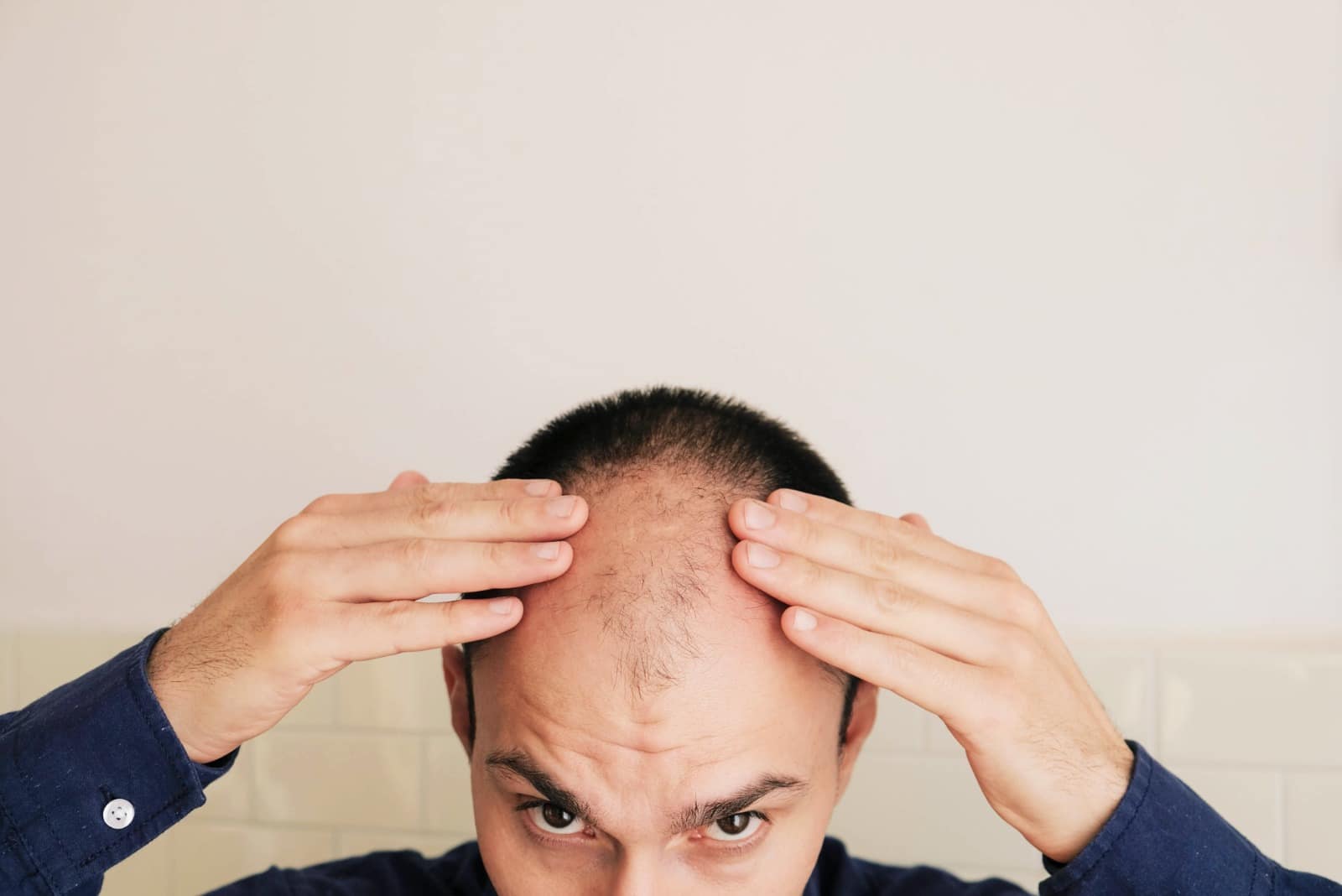 Explore the scientific insights into the causes and solutions for hair loss