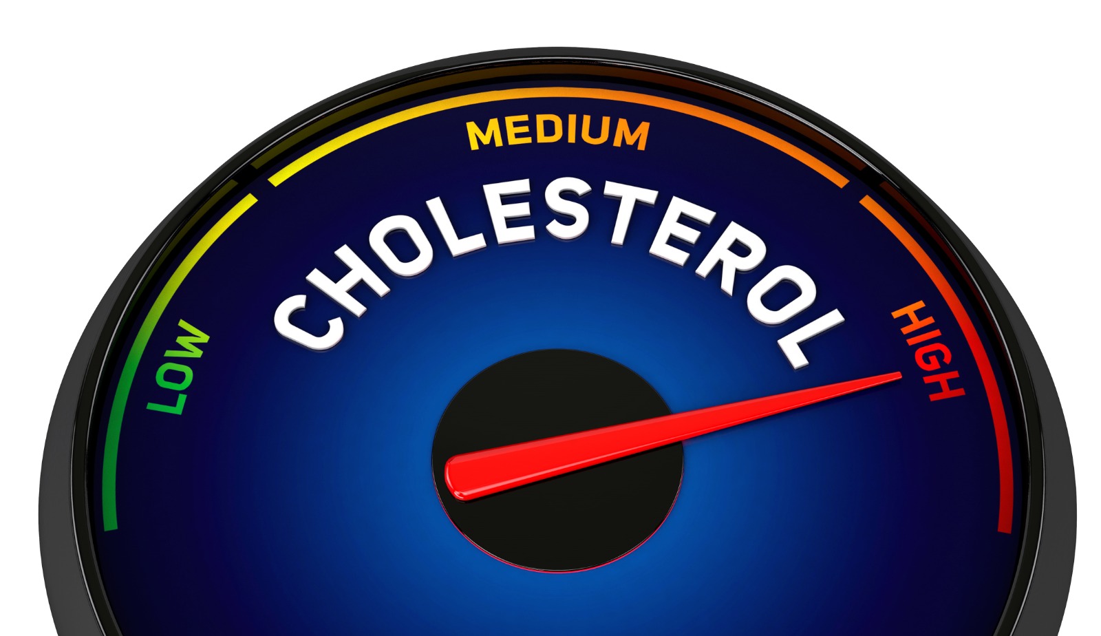 What is high cholesterol & how it can be managed?