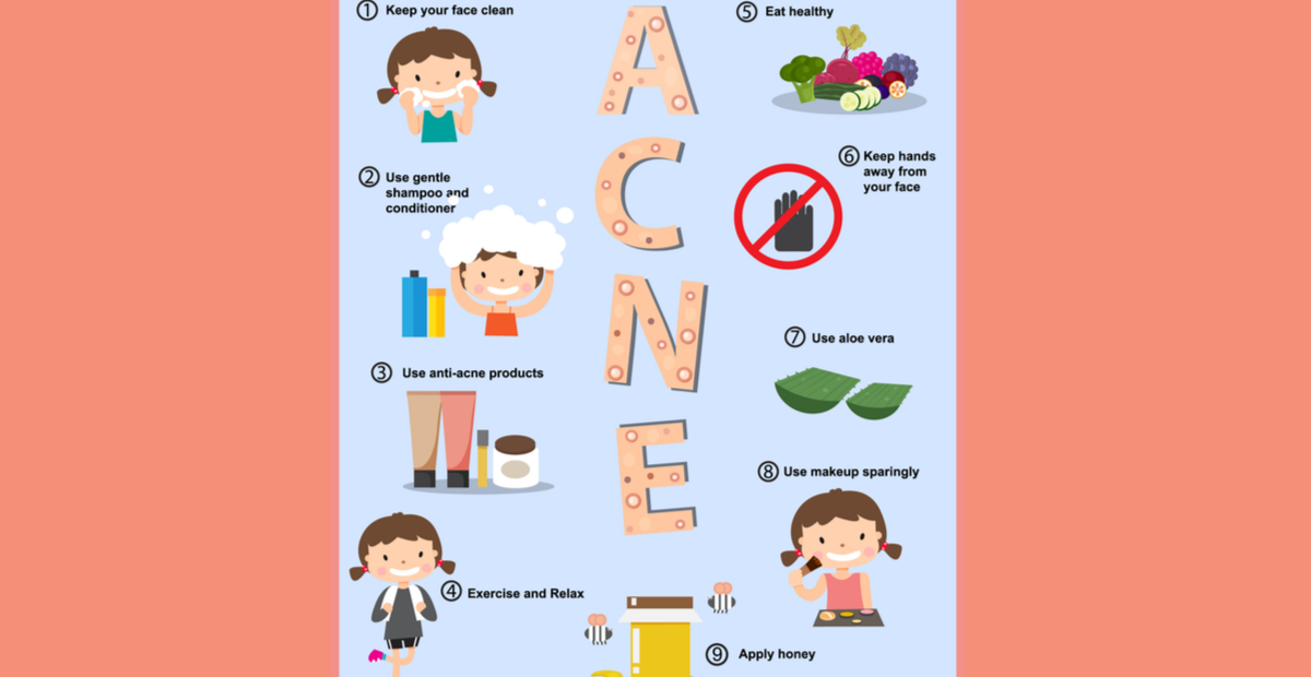 10 Interesting Ways to Prevent Acne in 2021