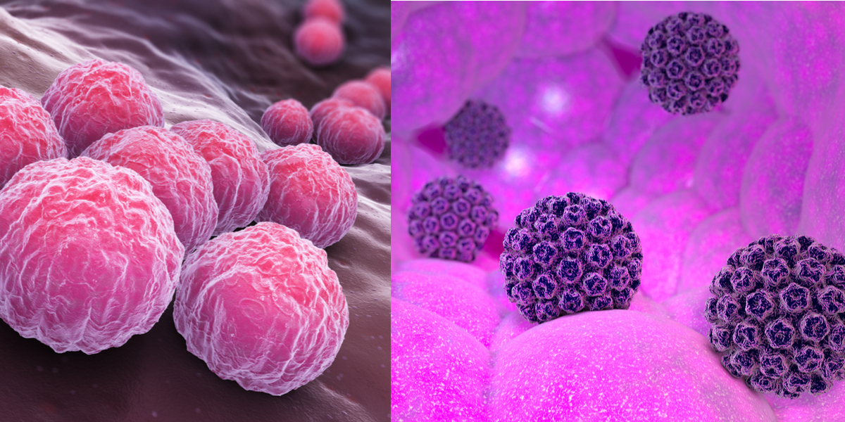 Difference Between Chlamydia and HPV