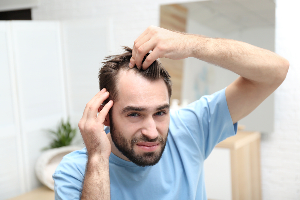 Is Finasteride an Effective Solution for Hair Loss? Find Out With Help from  Pharmacy Planet