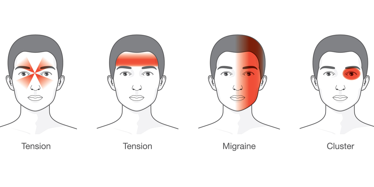 Is it a Tension Headache or Migraine?  Or Could it Be Both?