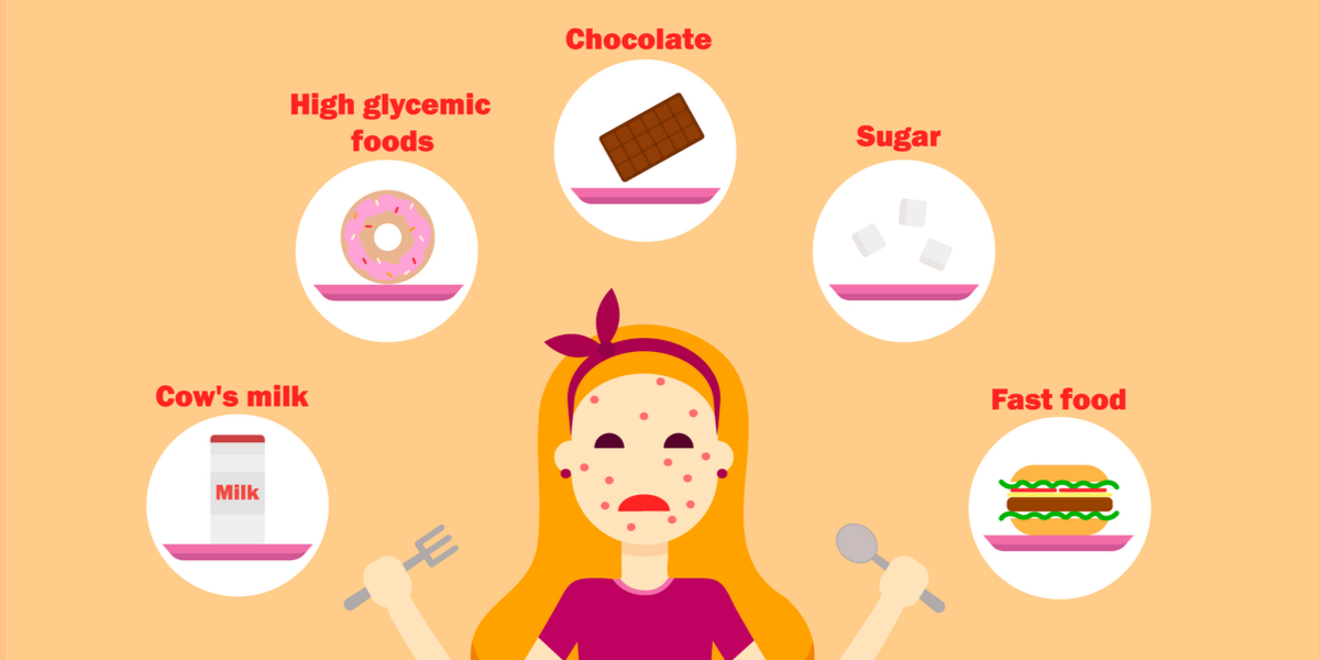 What Are the Top Foods that Cause Acne?