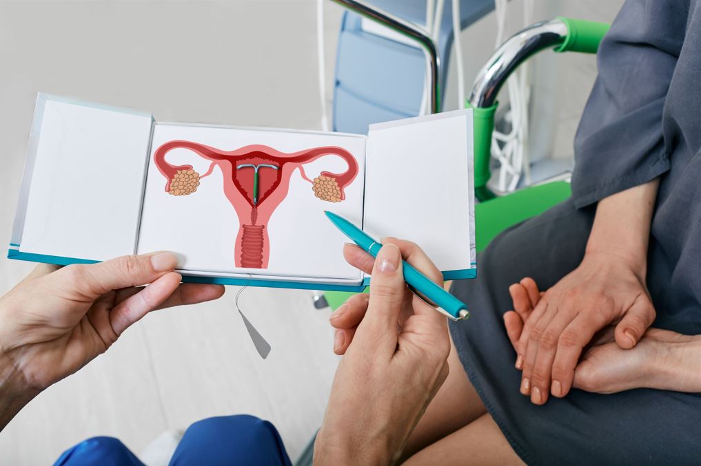 Prevent unwanted pregnancy with a copper intrauterine device