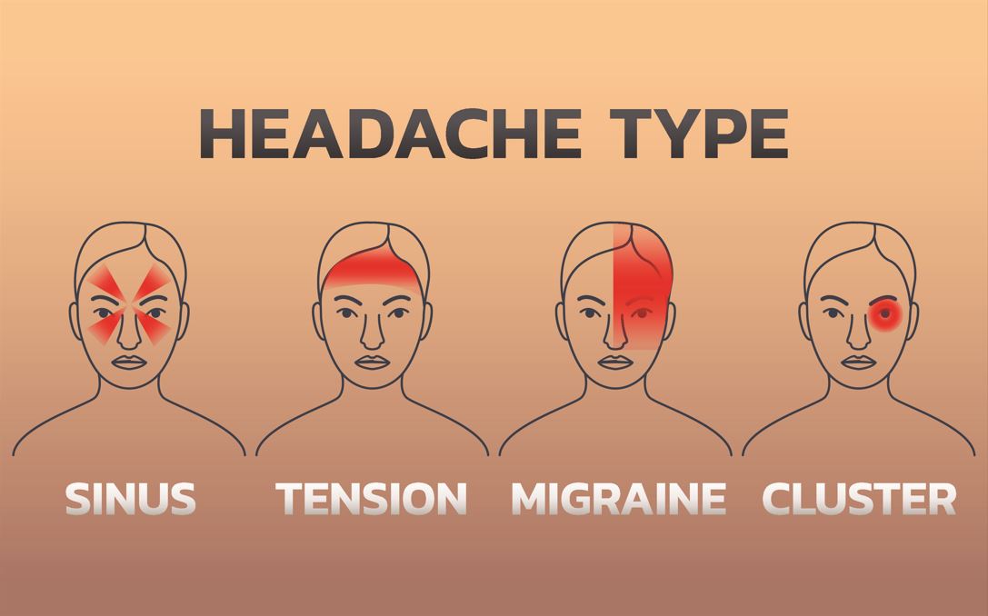 Understanding different types of headaches