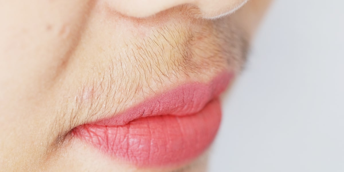 Is Waxing Good Or Bad For Hirsutism?